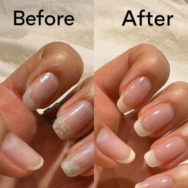 5 Day Nail Treatment